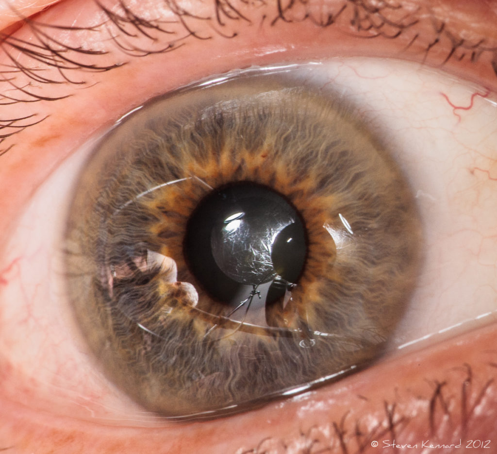 Iridology photograph - Steven Kennard 2012
